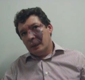 deputado federal reginal lopes
